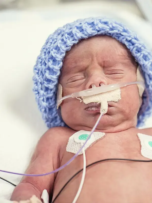 NEC Baby Formula Lawsuit 